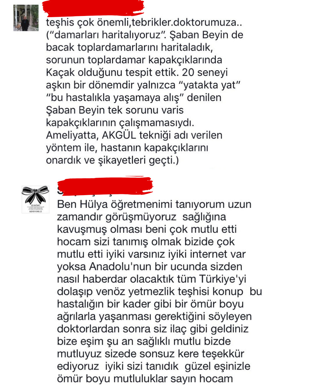 En iyi varisli bacak tedavisi